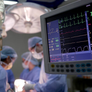 Know Your Heart Rate – When Should You Worry